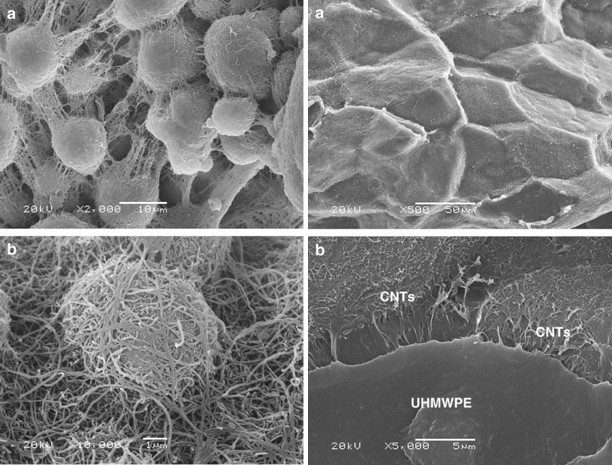 CNTs/UHMWPE composites with a two-dimensional conductive network 