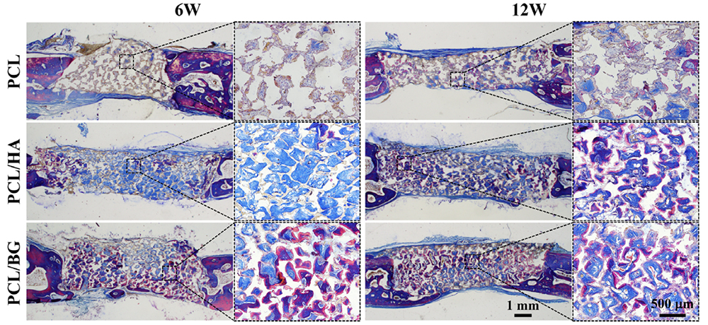 Role of HA and BG in engineering poly(ε-caprolactone) porous scaffolds for accelerating cranial bone regeneration.